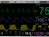 IRadimed 3880 Screen